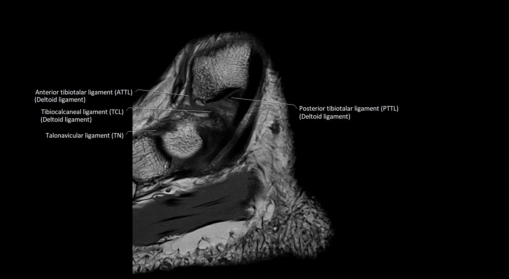 MRI ankle ligaments anatomy sagittal 3T image 4.webp